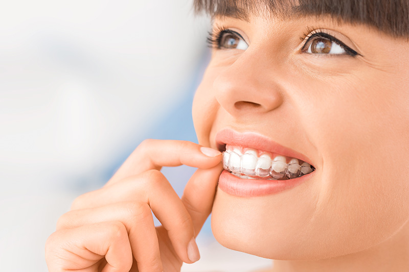 Orthodontics in San Ramon