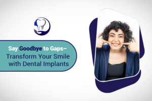 dental implants