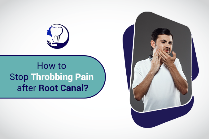 how to stop throbbing pain afetr root canal