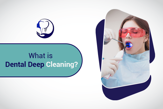 What is Dental Deep Cleaning?