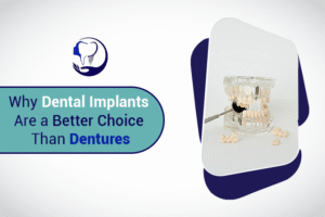 Why Dental Implants Are a Better Choice than Dentures