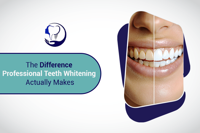 The Difference Professional Teeth Whitening Actually Makes