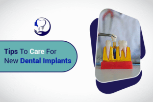 Tips to Care for New Dental Implants
