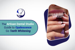 The Artisan Dental Studio Guide to Opalescence Go Teeth Whitening