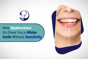 How Opalescence Go Gives You a Whiter Smile without Sensitivity